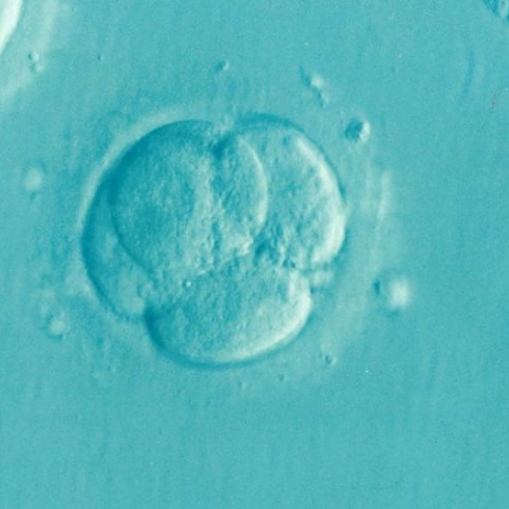 bracna-neplodnost-i-vantelesna-oplodnja